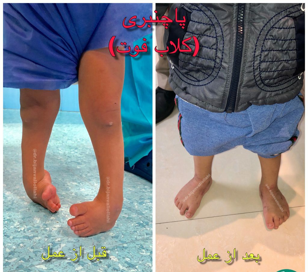 درمان